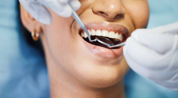 Best Broken or Chipped Tooth Repair in On Top Of The World Designated Place, FL